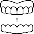 Porcelain Veneers