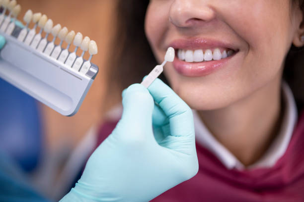 role of porcelain veneers in cosmetic dentistry